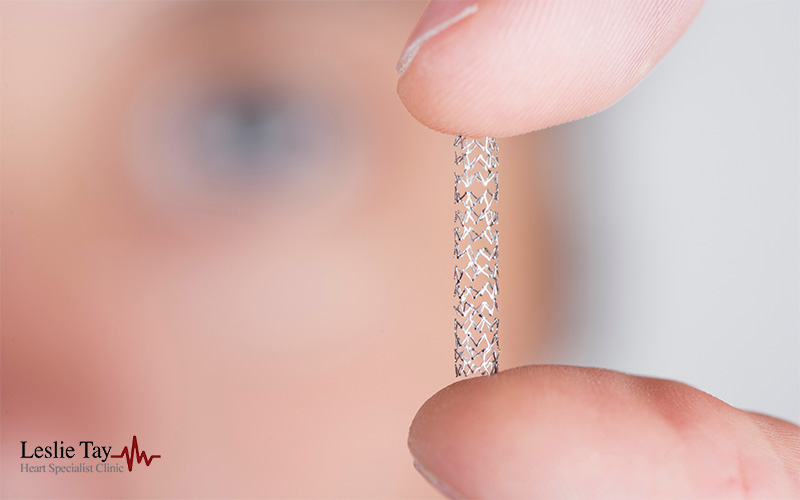 Heart Stent