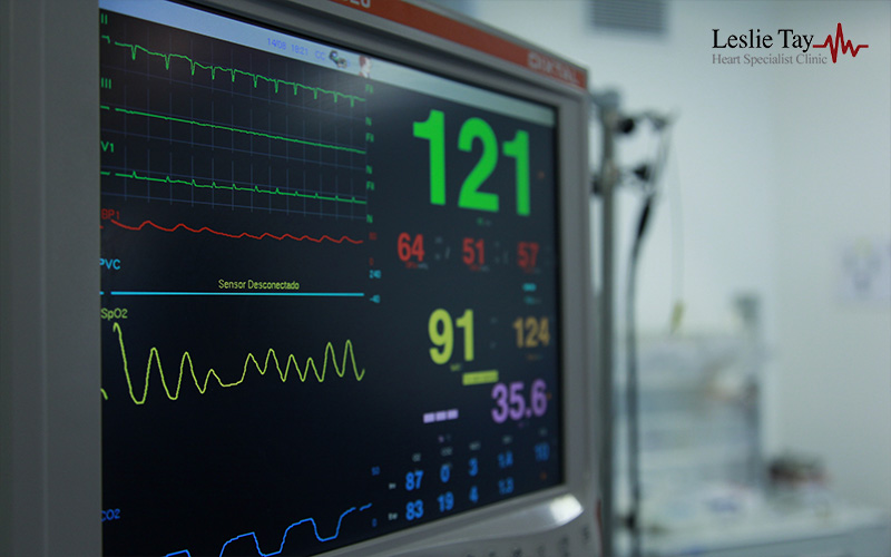 EKG Machine being used in a hospital