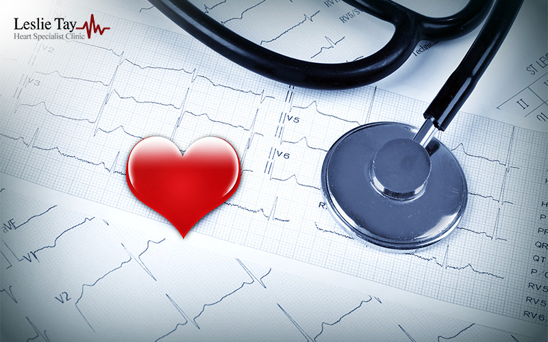 Heart specialist's stethoscope on ECG report for cardiac risk screening.
