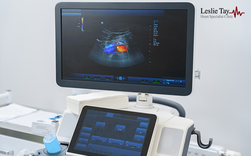 Ultrasound machine displaying color Doppler echocardiogram showing heart blood flow in a clinical setting.