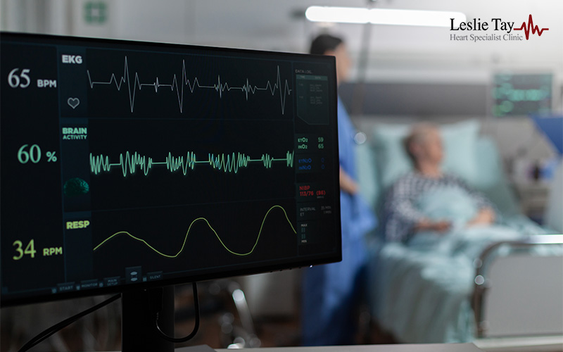 ECG monitor displaying vital signs in a heart clinic.