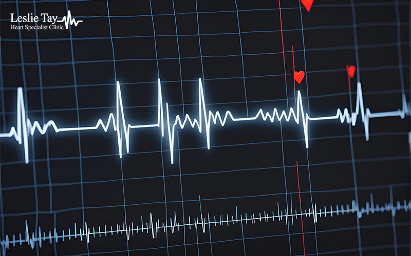 Heart specialist monitor showing an abnormal ECG reading.